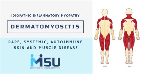 Afbeeldingsresultaten voor Dermatomyositis Muscle Weakness