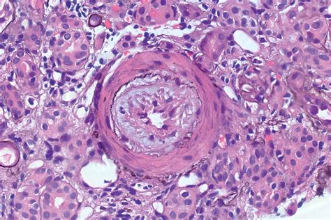 Chandra Observatory ਲਈ ਪ੍ਰਤੀਬਿੰਬ ਨਤੀਜਾ