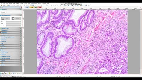Image result for High Cloud Microscope Software