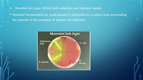 Differential Media Used in Microbiology に対する画像結果