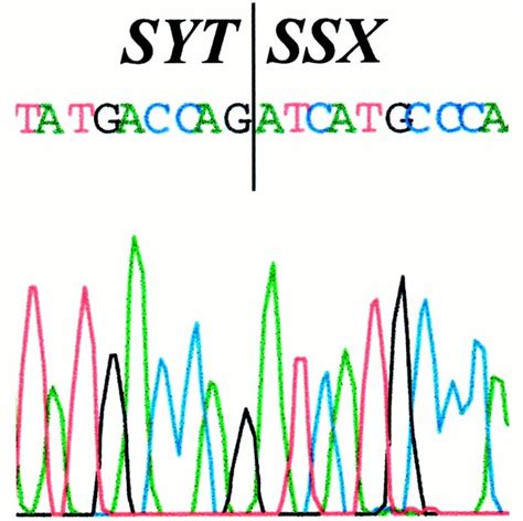 Reverse Transcriptase DNA Polymerase に対する画像結果