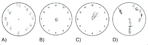 Image result for Visual Processing Disorder Clock Drawing