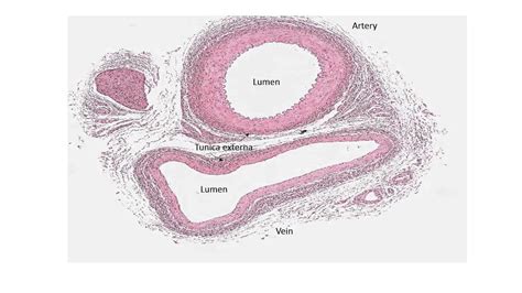 Transverse Section of Vein and Artery に対する画像結果