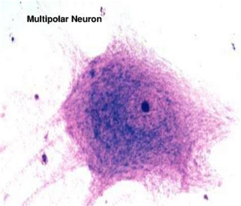 Image result for Giant Multipolar Neuron Microscope