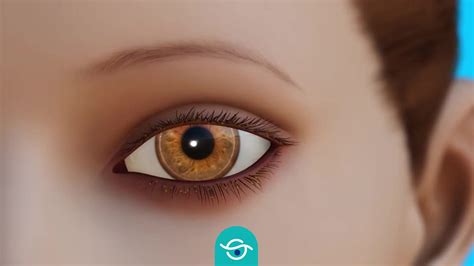 Toradh íomhá ar Blefaritis Demodex