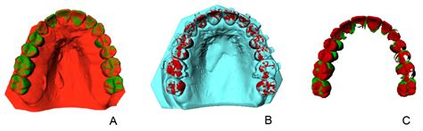 Image result for Best Fit Algorithm in Digital Dentistry