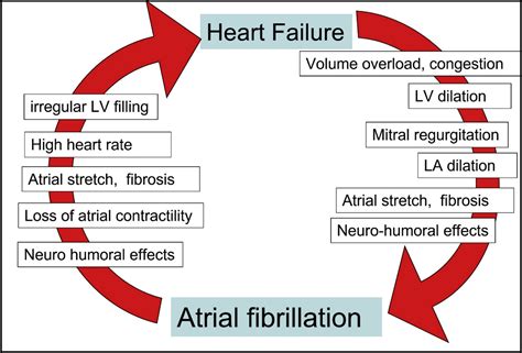 Image result for Atrial Fibrillation Heart Diagram
