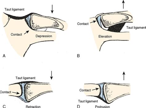 Image result for Codman's ROM