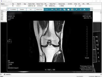 File Dcem に対する画像結果