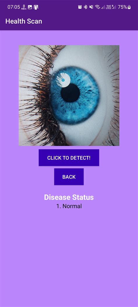 Image result for Eye Cataract Check App