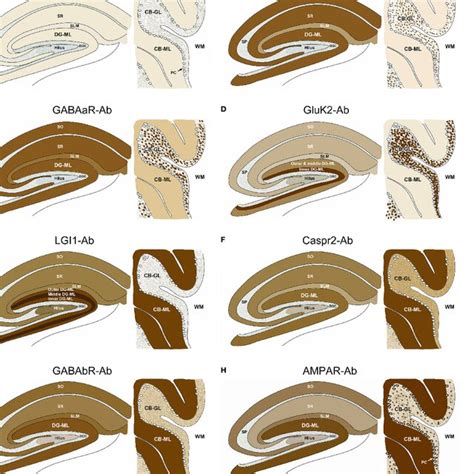 Immunostaining Pattern Types に対する画像結果
