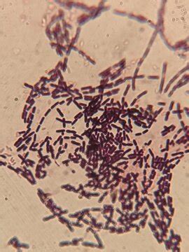 Bacteria Microscope Slides に対する画像結果