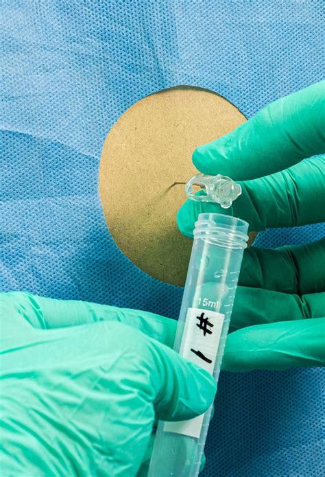 Mode of Sample Collection માટે ઇમેજ પરિણામ