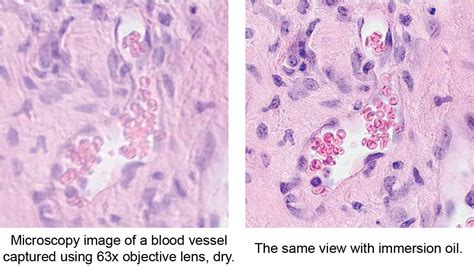 Immersion Microscope に対する画像結果