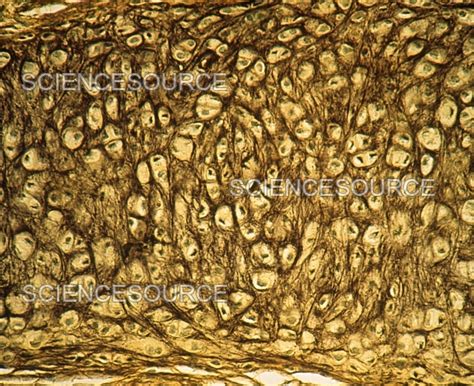 Image result for Elastic Cartilage 100X