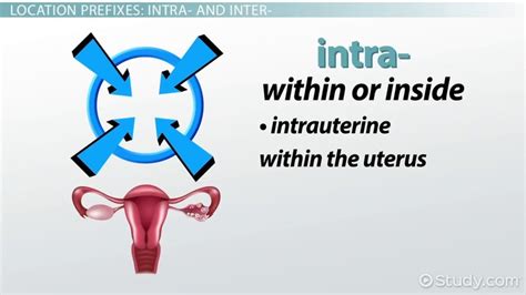 Image result for Intra Prefix Examples