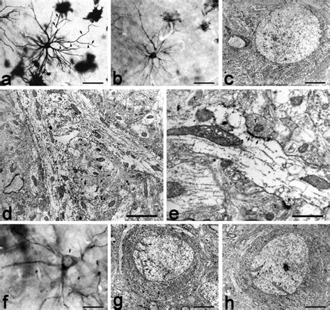 Résultat d’images pour Multipolar Neuron Under Microscope Labeled