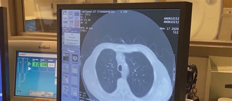 Toradh íomhá ar Pill That Can Be Cut in Half with Xx