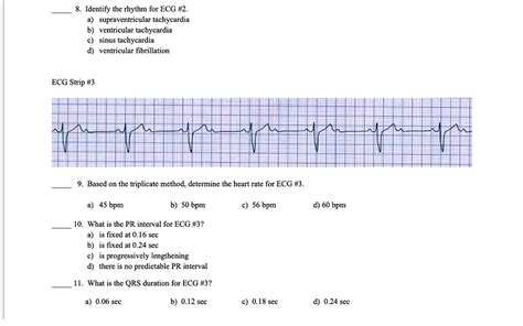 Triplicate Method ECG に対する画像結果