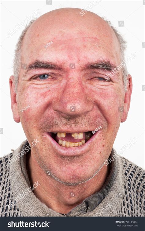 Toothless Men に対する画像結果