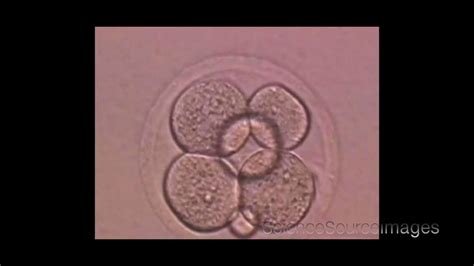 Image result for Human Embryo Electron Microscope
