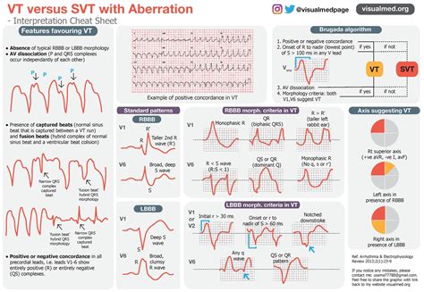 Image result for SVT vs AFib