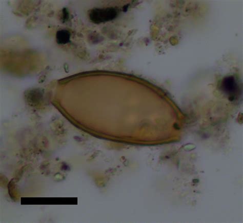 Parasitic Worm Eggs Human Stool に対する画像結果