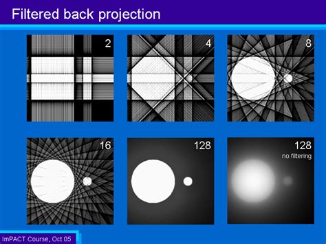 Image result for Unfiltered vs Filtered Back Projection