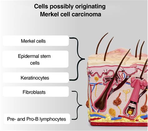 Afbeeldingsresultaten voor Merkel Cell Light Microscopy