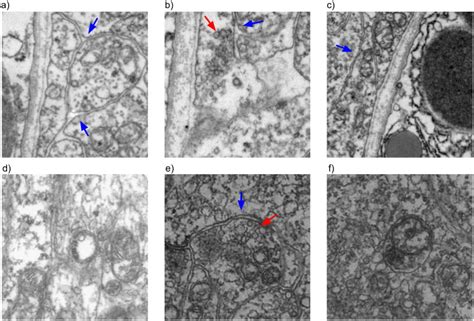 Neuron Under Electron Microscope に対する画像結果