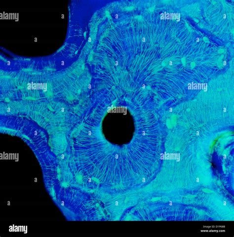 Image result for Compact Bone Micrograph