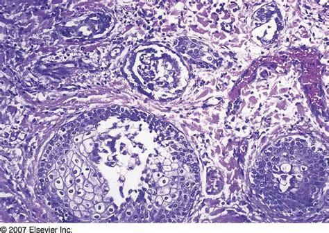 Image result for Stippled Cells