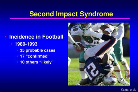 Image result for Second Impact Syndrome Diagram