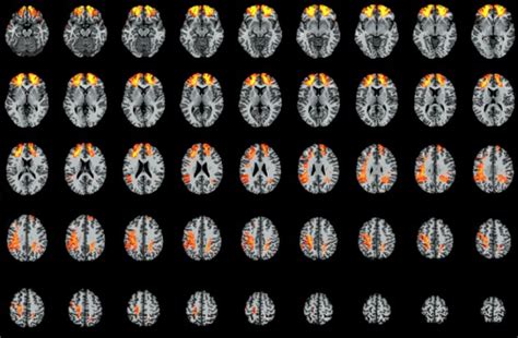 Image result for Discourse Comprehension Network Brain
