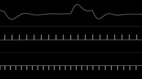 Toradh íomhá ar C64 Oscilloscope Screen Shot