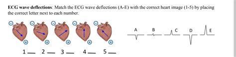 Image result for Negative Wave Deflection ECG