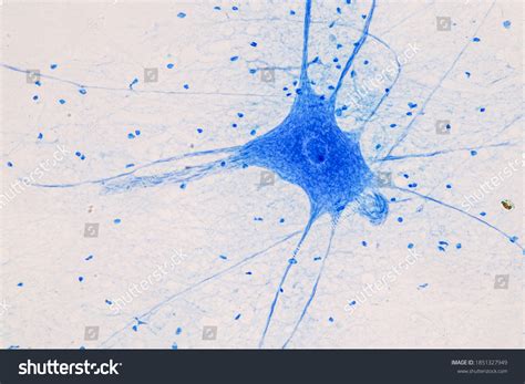 Mouse Brain Sample Under Microscope に対する画像結果