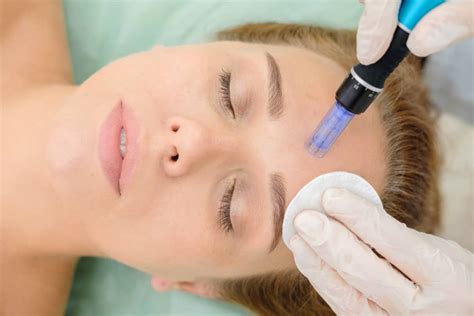 Image result for Needling Face Treatment