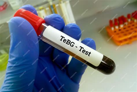 Image result for Test Lab IG BBG