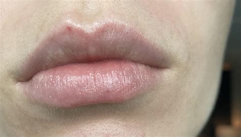 Afbeeldingsresultaten voor Small Red Dot On Nose