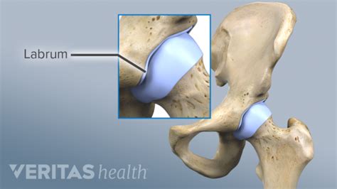 Right Hip Labrum に対する画像結果
