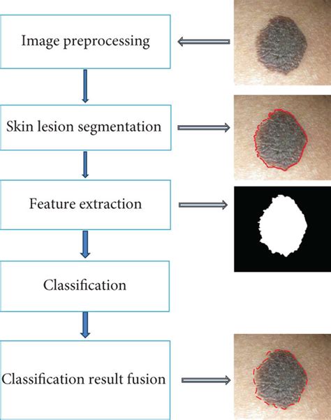 Image result for Image Recognition Machine Learning Flowchart Diagram