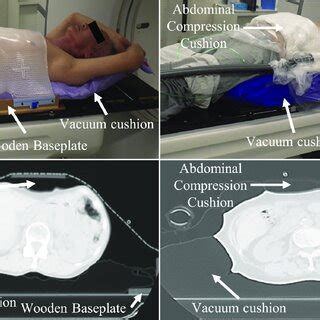 Image result for Abdominal Compression