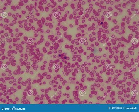 Normal Red Blood Cells Under Microscope-साठीचा प्रतिमा निकाल