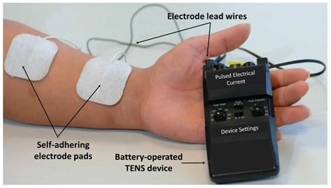 Transcutaneous Electrical Stimulation-এর ছবি ফলাফল