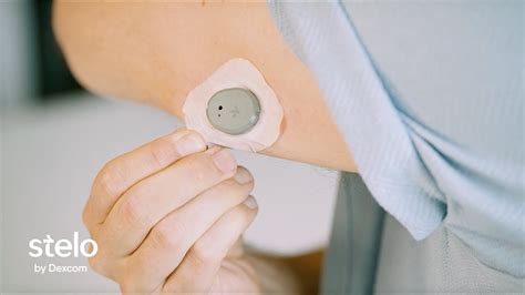 How to Apply Dexcom Sensor માટે ઇમેજ પરિણામ