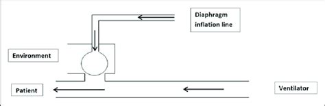 Pressure Control Exhalation Valve に対する画像結果