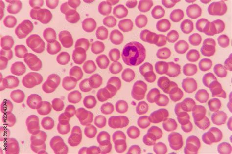 Normal Red Blood Cells Under Microscope-साठीचा प्रतिमा निकाल