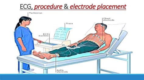 Image result for How to Use ECG Machine