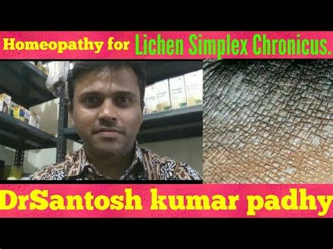 Image result for How to Cure Lichens Chronicus